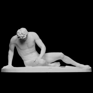 Dying Gaul